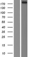 Western blot validation of overexpression lysate (Cat# LY411619) using anti-DDK antibody (Cat# TA50011-100). Left: Cell lysates from un-transfected HEK293T cells; Right: Cell lysates from HEK293T cells transfected with RC224050 using transfection reagent MegaTran 2.0 (Cat# TT210002).