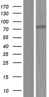 Western blot validation of overexpression lysate (Cat# LY408552) using anti-DDK antibody (Cat# TA50011-100). Left: Cell lysates from un-transfected HEK293T cells; Right: Cell lysates from HEK293T cells transfected with RC224779 using transfection reagent MegaTran 2.0 (Cat# TT210002).