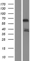 Western blot validation of overexpression lysate (Cat# LY409905) using anti-DDK antibody (Cat# TA50011-100). Left: Cell lysates from un-transfected HEK293T cells; Right: Cell lysates from HEK293T cells transfected with RC224850 using transfection reagent MegaTran 2.0 (Cat# TT210002).