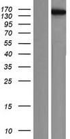 Western blot validation of overexpression lysate (Cat# LY420429) using anti-DDK antibody (Cat# TA50011-100). Left: Cell lysates from un-transfected HEK293T cells; Right: Cell lysates from HEK293T cells transfected with RC224930 using transfection reagent MegaTran 2.0 (Cat# TT210002).