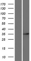 Western blot validation of overexpression lysate (Cat# LY422893) using anti-DDK antibody (Cat# TA50011-100). Left: Cell lysates from un-transfected HEK293T cells; Right: Cell lysates from HEK293T cells transfected with RC224912 using transfection reagent MegaTran 2.0 (Cat# TT210002).