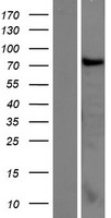 Western blot validation of overexpression lysate (Cat# LY410029) using anti-DDK antibody (Cat# TA50011-100). Left: Cell lysates from un-transfected HEK293T cells; Right: Cell lysates from HEK293T cells transfected with RC224637 using transfection reagent MegaTran 2.0 (Cat# TT210002).