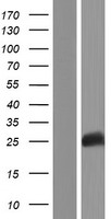 Western blot validation of overexpression lysate (Cat# LY409150) using anti-DDK antibody (Cat# TA50011-100). Left: Cell lysates from un-transfected HEK293T cells; Right: Cell lysates from HEK293T cells transfected with RC224722 using transfection reagent MegaTran 2.0 (Cat# TT210002).