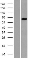 Western blot validation of overexpression lysate (Cat# LY422506) using anti-DDK antibody (Cat# TA50011-100). Left: Cell lysates from un-transfected HEK293T cells; Right: Cell lysates from HEK293T cells transfected with RC223344 using transfection reagent MegaTran 2.0 (Cat# TT210002).