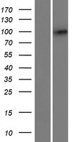 Western blot validation of overexpression lysate (Cat# LY420731) using anti-DDK antibody (Cat# TA50011-100). Left: Cell lysates from un-transfected HEK293T cells; Right: Cell lysates from HEK293T cells transfected with RC223339 using transfection reagent MegaTran 2.0 (Cat# TT210002).