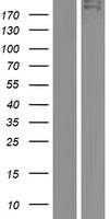 Western blot validation of overexpression lysate (Cat# LY423196) using anti-DDK antibody (Cat# TA50011-100). Left: Cell lysates from un-transfected HEK293T cells; Right: Cell lysates from HEK293T cells transfected with RC223325 using transfection reagent MegaTran 2.0 (Cat# TT210002).