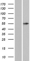 Western blot validation of overexpression lysate (Cat# LY405417) using anti-DDK antibody (Cat# TA50011-100). Left: Cell lysates from un-transfected HEK293T cells; Right: Cell lysates from HEK293T cells transfected with RC223253 using transfection reagent MegaTran 2.0 (Cat# TT210002).