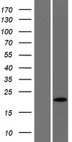 Western blot validation of overexpression lysate (Cat# LY412461) using anti-DDK antibody (Cat# TA50011-100). Left: Cell lysates from un-transfected HEK293T cells; Right: Cell lysates from HEK293T cells transfected with RC223236 using transfection reagent MegaTran 2.0 (Cat# TT210002).