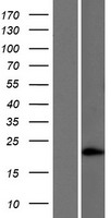 Western blot validation of overexpression lysate (Cat# LY422245) using anti-DDK antibody (Cat# TA50011-100). Left: Cell lysates from un-transfected HEK293T cells; Right: Cell lysates from HEK293T cells transfected with RC222942 using transfection reagent MegaTran 2.0 (Cat# TT210002).