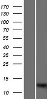 Western blot validation of overexpression lysate (Cat# LY420753) using anti-DDK antibody (Cat# TA50011-100). Left: Cell lysates from un-transfected HEK293T cells; Right: Cell lysates from HEK293T cells transfected with RC223024 using transfection reagent MegaTran 2.0 (Cat# TT210002).