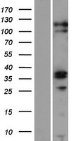 Western blot validation of overexpression lysate (Cat# LY409573) using anti-DDK antibody (Cat# TA50011-100). Left: Cell lysates from un-transfected HEK293T cells; Right: Cell lysates from HEK293T cells transfected with RC223705 using transfection reagent MegaTran 2.0 (Cat# TT210002).