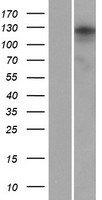 Western blot validation of overexpression lysate (Cat# LY408809) using anti-DDK antibody (Cat# TA50011-100). Left: Cell lysates from un-transfected HEK293T cells; Right: Cell lysates from HEK293T cells transfected with RC223342 using transfection reagent MegaTran 2.0 (Cat# TT210002).