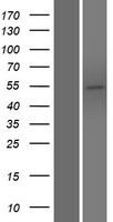 Western blot validation of overexpression lysate (Cat# LY410849) using anti-DDK antibody (Cat# TA50011-100). Left: Cell lysates from un-transfected HEK293T cells; Right: Cell lysates from HEK293T cells transfected with RC223676 using transfection reagent MegaTran 2.0 (Cat# TT210002).