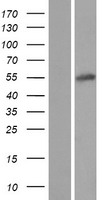 Western blot validation of overexpression lysate (Cat# LY411110) using anti-DDK antibody (Cat# TA50011-100). Left: Cell lysates from un-transfected HEK293T cells; Right: Cell lysates from HEK293T cells transfected with RC223805 using transfection reagent MegaTran 2.0 (Cat# TT210002).