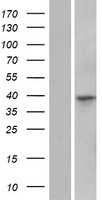 Western blot validation of overexpression lysate (Cat# LY423203) using anti-DDK antibody (Cat# TA50011-100). Left: Cell lysates from un-transfected HEK293T cells; Right: Cell lysates from HEK293T cells transfected with RC223803 using transfection reagent MegaTran 2.0 (Cat# TT210002).