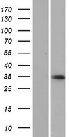 Western blot validation of overexpression lysate (Cat# LY423375) using anti-DDK antibody (Cat# TA50011-100). Left: Cell lysates from un-transfected HEK293T cells; Right: Cell lysates from HEK293T cells transfected with RC223498 using transfection reagent MegaTran 2.0 (Cat# TT210002).