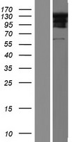 Western blot validation of overexpression lysate (Cat# LY423213) using anti-DDK antibody (Cat# TA50011-100). Left: Cell lysates from un-transfected HEK293T cells; Right: Cell lysates from HEK293T cells transfected with RC223494 using transfection reagent MegaTran 2.0 (Cat# TT210002).
