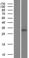 Western blot validation of overexpression lysate (Cat# LY424094) using anti-DDK antibody (Cat# TA50011-100). Left: Cell lysates from un-transfected HEK293T cells; Right: Cell lysates from HEK293T cells transfected with RC221534 using transfection reagent MegaTran 2.0 (Cat# TT210002).
