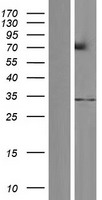 Western blot validation of overexpression lysate (Cat# LY434113) using anti-DDK antibody (Cat# TA50011-100). Left: Cell lysates from un-transfected HEK293T cells; Right: Cell lysates from HEK293T cells transfected with RC231114 using transfection reagent MegaTran 2.0 (Cat# TT210002).
