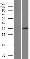 Western blot validation of overexpression lysate (Cat# LY428663) using anti-DDK antibody (Cat# TA50011-100). Left: Cell lysates from un-transfected HEK293T cells; Right: Cell lysates from HEK293T cells transfected with RC227734 using transfection reagent MegaTran 2.0 (Cat# TT210002).