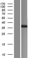 Western blot validation of overexpression lysate (Cat# LY407767) using anti-DDK antibody (Cat# TA50011-100). Left: Cell lysates from un-transfected HEK293T cells; Right: Cell lysates from HEK293T cells transfected with RC222996 using transfection reagent MegaTran 2.0 (Cat# TT210002).