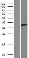Western blot validation of overexpression lysate (Cat# LY426309) using anti-DDK antibody (Cat# TA50011-100). Left: Cell lysates from un-transfected HEK293T cells; Right: Cell lysates from HEK293T cells transfected with RC225445 using transfection reagent MegaTran 2.0 (Cat# TT210002).