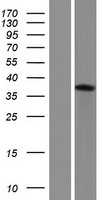 Western blot validation of overexpression lysate (Cat# LY404964) using anti-DDK antibody (Cat# TA50011-100). Left: Cell lysates from un-transfected HEK293T cells; Right: Cell lysates from HEK293T cells transfected with RC223249 using transfection reagent MegaTran 2.0 (Cat# TT210002).