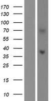 Western blot validation of overexpression lysate (Cat# LY421945) using anti-DDK antibody (Cat# TA50011-100). Left: Cell lysates from un-transfected HEK293T cells; Right: Cell lysates from HEK293T cells transfected with RC211697 using transfection reagent MegaTran 2.0 (Cat# TT210002).