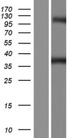 Western blot validation of overexpression lysate (Cat# LY421035) using anti-DDK antibody (Cat# TA50011-100). Left: Cell lysates from un-transfected HEK293T cells; Right: Cell lysates from HEK293T cells transfected with RC218281 using transfection reagent MegaTran 2.0 (Cat# TT210002).