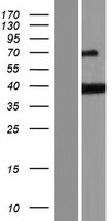Western blot validation of overexpression lysate (Cat# LY423125) using anti-DDK antibody (Cat# TA50011-100). Left: Cell lysates from un-transfected HEK293T cells; Right: Cell lysates from HEK293T cells transfected with RC213384 using transfection reagent MegaTran 2.0 (Cat# TT210002).