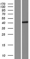 Western blot validation of overexpression lysate (Cat# LY428024) using anti-DDK antibody (Cat# TA50011-100). Left: Cell lysates from un-transfected HEK293T cells; Right: Cell lysates from HEK293T cells transfected with RC226834 using transfection reagent MegaTran 2.0 (Cat# TT210002).