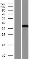 Western blot validation of overexpression lysate (Cat# LY404057) using anti-DDK antibody (Cat# TA50011-100). Left: Cell lysates from un-transfected HEK293T cells; Right: Cell lysates from HEK293T cells transfected with RC221583 using transfection reagent MegaTran 2.0 (Cat# TT210002).