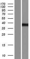 Western blot validation of overexpression lysate (Cat# LY404297) using anti-DDK antibody (Cat# TA50011-100). Left: Cell lysates from un-transfected HEK293T cells; Right: Cell lysates from HEK293T cells transfected with RC215779 using transfection reagent MegaTran 2.0 (Cat# TT210002).