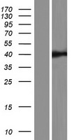 Western blot validation of overexpression lysate (Cat# LY406101) using anti-DDK antibody (Cat# TA50011-100). Left: Cell lysates from un-transfected HEK293T cells; Right: Cell lysates from HEK293T cells transfected with RC218036 using transfection reagent MegaTran 2.0 (Cat# TT210002).