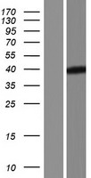 Western blot validation of overexpression lysate (Cat# LY428523) using anti-DDK antibody (Cat# TA50011-100). Left: Cell lysates from un-transfected HEK293T cells; Right: Cell lysates from HEK293T cells transfected with RC228002 using transfection reagent MegaTran 2.0 (Cat# TT210002).