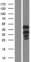 Western blot validation of overexpression lysate (Cat# LY431306) using anti-DDK antibody (Cat# TA50011-100). Left: Cell lysates from un-transfected HEK293T cells; Right: Cell lysates from HEK293T cells transfected with RC228278 using transfection reagent MegaTran 2.0 (Cat# TT210002).
