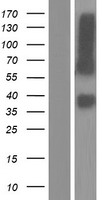 Western blot validation of overexpression lysate (Cat# LY404370) using anti-DDK antibody (Cat# TA50011-100). Left: Cell lysates from un-transfected HEK293T cells; Right: Cell lysates from HEK293T cells transfected with RC215930 using transfection reagent MegaTran 2.0 (Cat# TT210002).