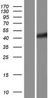 Western blot validation of overexpression lysate (Cat# LY428661) using anti-DDK antibody (Cat# TA50011-100). Left: Cell lysates from un-transfected HEK293T cells; Right: Cell lysates from HEK293T cells transfected with RC227721 using transfection reagent MegaTran 2.0 (Cat# TT210002).