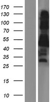 Western blot validation of overexpression lysate (Cat# LY421252) using anti-DDK antibody (Cat# TA50011-100). Left: Cell lysates from un-transfected HEK293T cells; Right: Cell lysates from HEK293T cells transfected with RC212875 using transfection reagent MegaTran 2.0 (Cat# TT210002).