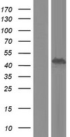 Western blot validation of overexpression lysate (Cat# LY434191) using anti-DDK antibody (Cat# TA50011-100). Left: Cell lysates from un-transfected HEK293T cells; Right: Cell lysates from HEK293T cells transfected with RC231192 using transfection reagent MegaTran 2.0 (Cat# TT210002).