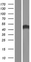 Western blot validation of overexpression lysate (Cat# LY420193) using anti-DDK antibody (Cat# TA50011-100). Left: Cell lysates from un-transfected HEK293T cells; Right: Cell lysates from HEK293T cells transfected with RC218463 using transfection reagent MegaTran 2.0 (Cat# TT210002).