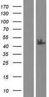 Western blot validation of overexpression lysate (Cat# LY432987) using anti-DDK antibody (Cat# TA50011-100). Left: Cell lysates from un-transfected HEK293T cells; Right: Cell lysates from HEK293T cells transfected with RC229987 using transfection reagent MegaTran 2.0 (Cat# TT210002).
