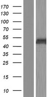 Western blot validation of overexpression lysate (Cat# LY405943) using anti-DDK antibody (Cat# TA50011-100). Left: Cell lysates from un-transfected HEK293T cells; Right: Cell lysates from HEK293T cells transfected with RC216247 using transfection reagent MegaTran 2.0 (Cat# TT210002).