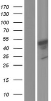 Western blot validation of overexpression lysate (Cat# LY420824) using anti-DDK antibody (Cat# TA50011-100). Left: Cell lysates from un-transfected HEK293T cells; Right: Cell lysates from HEK293T cells transfected with RC216864 using transfection reagent MegaTran 2.0 (Cat# TT210002).