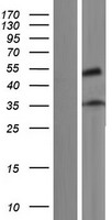 Western blot validation of overexpression lysate (Cat# LY433036) using anti-DDK antibody (Cat# TA50011-100). Left: Cell lysates from un-transfected HEK293T cells; Right: Cell lysates from HEK293T cells transfected with RC230036 using transfection reagent MegaTran 2.0 (Cat# TT210002).