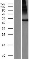 Western blot validation of overexpression lysate (Cat# LY409941) using anti-DDK antibody (Cat# TA50011-100). Left: Cell lysates from un-transfected HEK293T cells; Right: Cell lysates from HEK293T cells transfected with RC211640 using transfection reagent MegaTran 2.0 (Cat# TT210002).