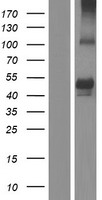 Western blot validation of overexpression lysate (Cat# LY410441) using anti-DDK antibody (Cat# TA50011-100). Left: Cell lysates from un-transfected HEK293T cells; Right: Cell lysates from HEK293T cells transfected with RC221833 using transfection reagent MegaTran 2.0 (Cat# TT210002).