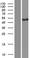 Western blot validation of overexpression lysate (Cat# LY431364) using anti-DDK antibody (Cat# TA50011-100). Left: Cell lysates from un-transfected HEK293T cells; Right: Cell lysates from HEK293T cells transfected with RC228336 using transfection reagent MegaTran 2.0 (Cat# TT210002).