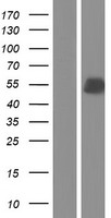 Western blot validation of overexpression lysate (Cat# LY408679) using anti-DDK antibody (Cat# TA50011-100). Left: Cell lysates from un-transfected HEK293T cells; Right: Cell lysates from HEK293T cells transfected with RC217301 using transfection reagent MegaTran 2.0 (Cat# TT210002).