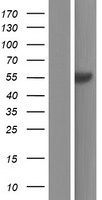 Western blot validation of overexpression lysate (Cat# LY431381) using anti-DDK antibody (Cat# TA50011-100). Left: Cell lysates from un-transfected HEK293T cells; Right: Cell lysates from HEK293T cells transfected with RC228353 using transfection reagent MegaTran 2.0 (Cat# TT210002).